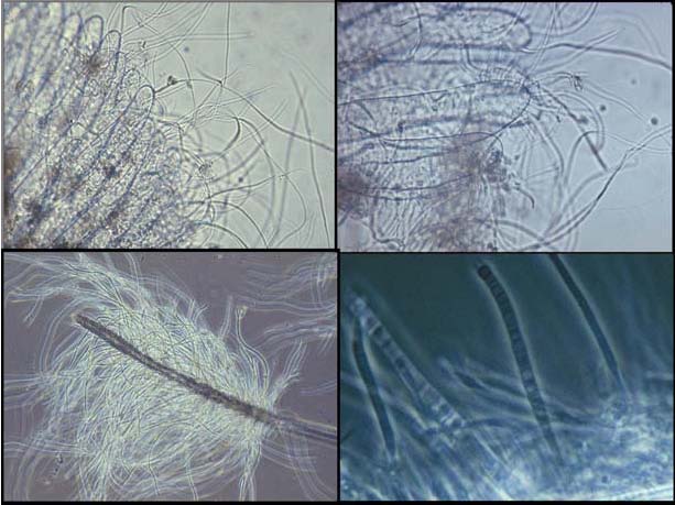 banh-do-vi-khuan-dang-soi