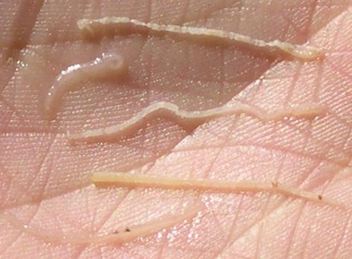 Tôm bị bệnh phân trắng